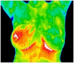 thermography